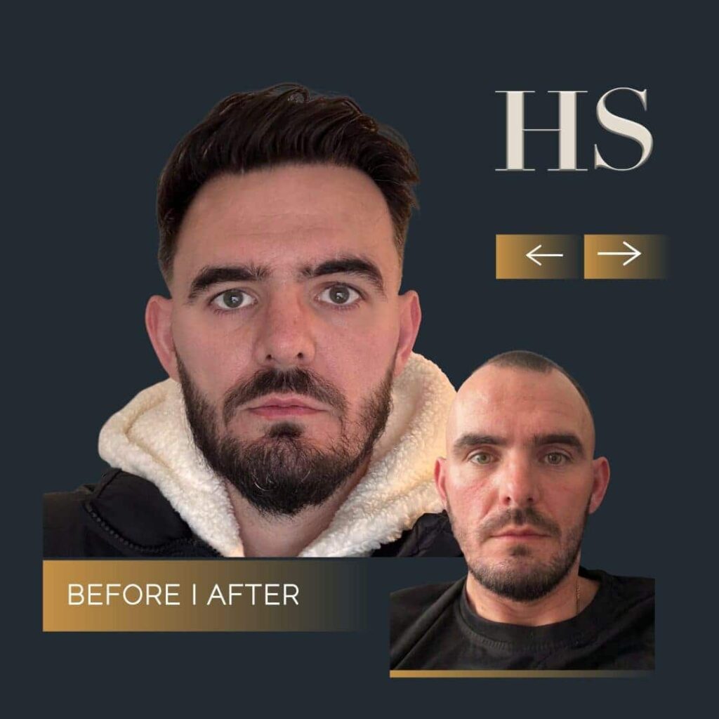 Home 5 Home 5