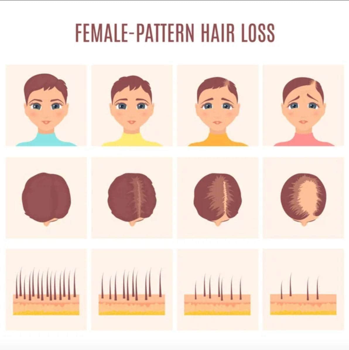 Hair Today, Gone Tomorrow: What Your Hairline is Trying to Tell You
